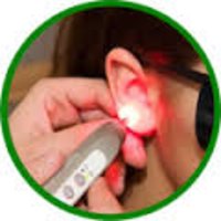 Akupunktur am Ohr mit einem Laser