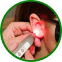 Akupunktur am Ohr mit einem Laser